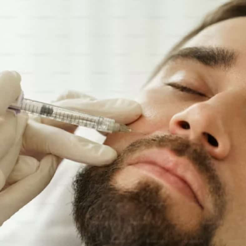 Close-up of a cosmetic procedure treating nasolabial folds with dermal fillers.