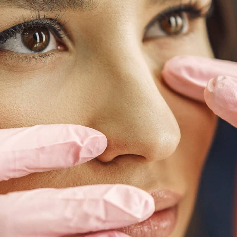 Close-up of woman receiving non-surgical rhinoplasty at Dolce Aesthetics clinic.