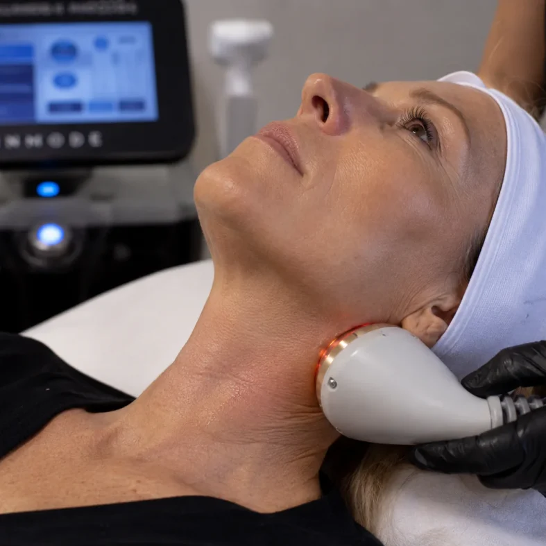 A woman gets a radiofrequency skin treatment on her neck at a clinic, technician in black gloves.